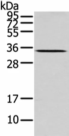 UCP2 Polyclonal Antibody - image 1