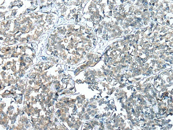 COMMD6 Polyclonal Antibody - image 1
