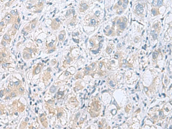 GPCPD1 Polyclonal Antibody - image 1