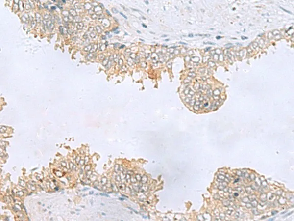 GPCPD1 Polyclonal Antibody - image 2