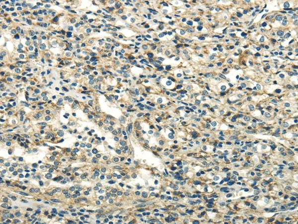 DLAT Polyclonal Antibody - image 1