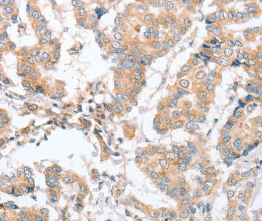 PARD6A Polyclonal Antibody - image 1