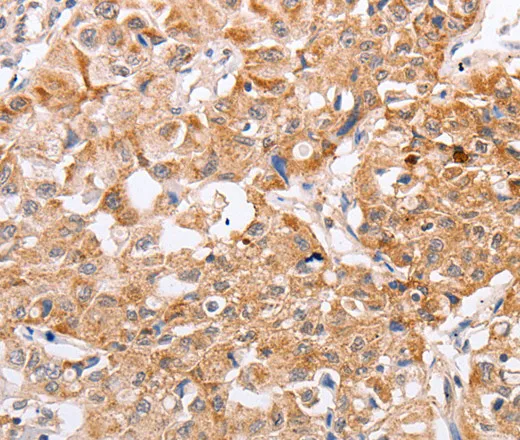 PPP1CB Polyclonal Antibody - image 1