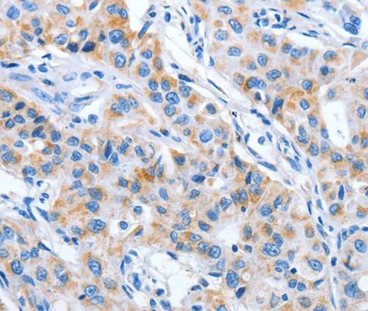 IMMT Polyclonal Antibody - image 1