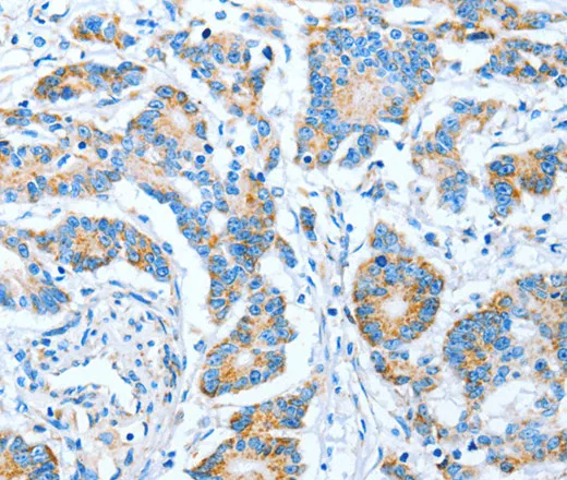 IMMT Polyclonal Antibody - image 2