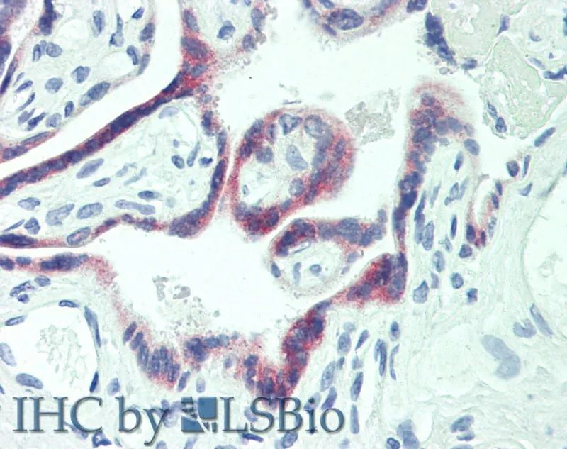 PAPPA Polyclonal Antibody - image 1