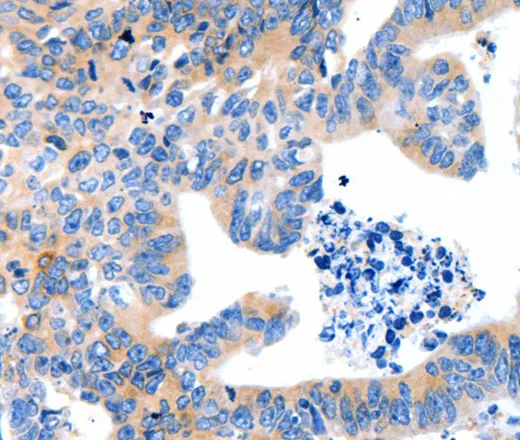 LRPAP1 Polyclonal Antibody - image 1