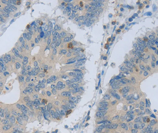 MAGEB4 Polyclonal Antibody - image 1