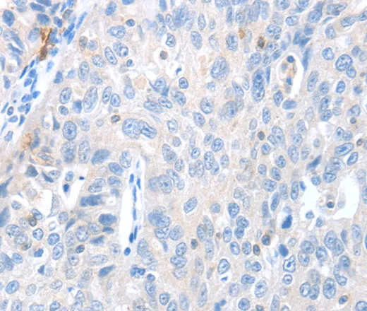 MAGEB4 Polyclonal Antibody - image 2
