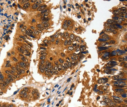 ADAP1 Polyclonal Antibody - image 1