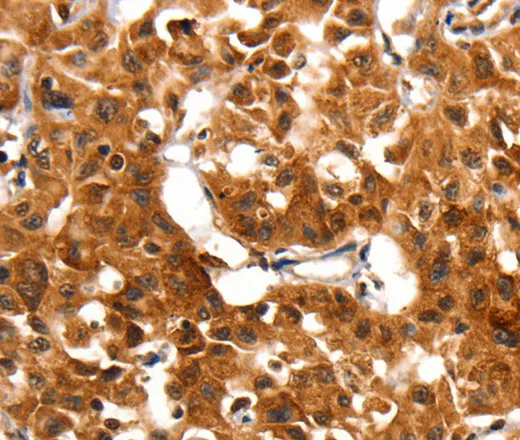 ADAP1 Polyclonal Antibody - image 2