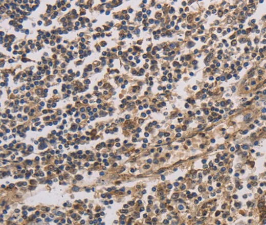 HSF1 Polyclonal Antibody - image 1