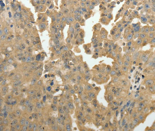 PSMD9 Polyclonal Antibody - image 1