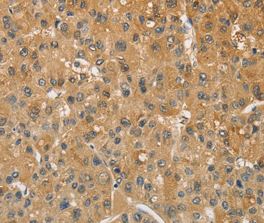 AMZ2 Polyclonal Antibody - image 1