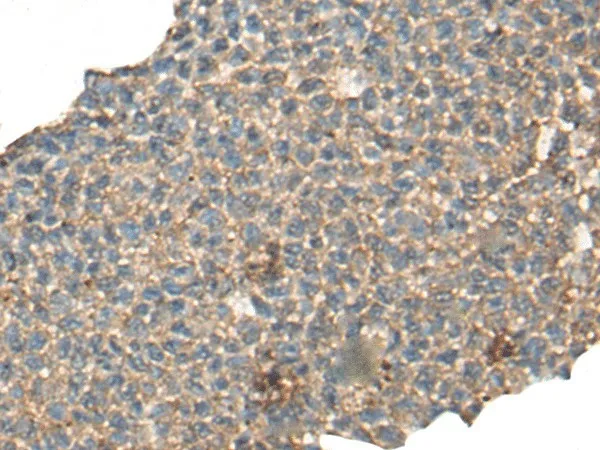 CABP5 Polyclonal Antibody - image 1