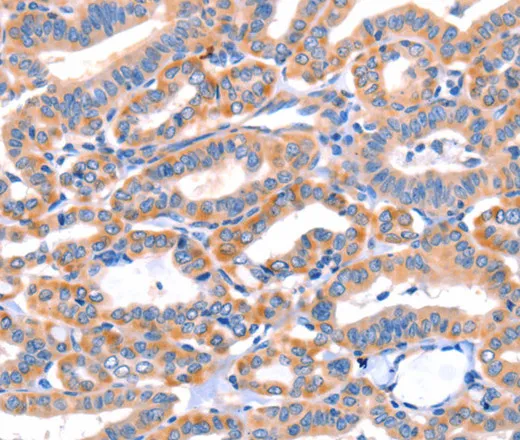AP1B1 Polyclonal Antibody - image 1