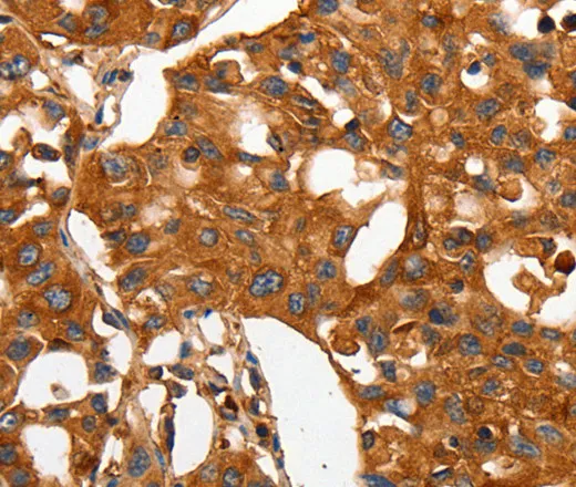 CAP2 Polyclonal Antibody - image 1