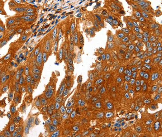 CAP2 Polyclonal Antibody - image 2