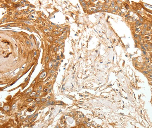 TERT Polyclonal Antibody - image 1