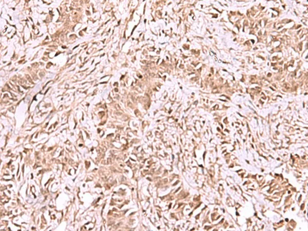 CDKN1B Polyclonal Antibody - image 1