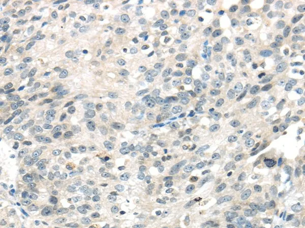 IQGAP2 Polyclonal Antibody - image 1