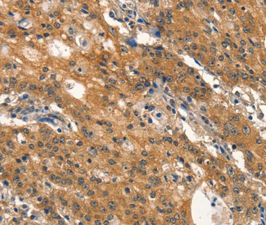 DNM2 Polyclonal Antibody - image 1