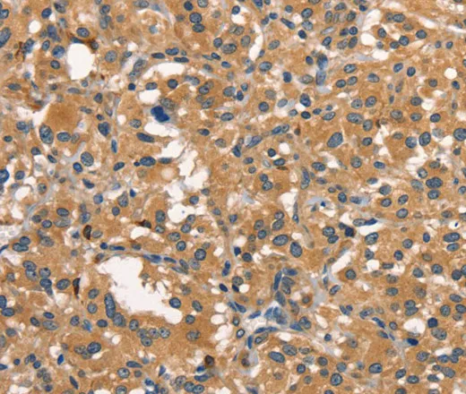 DNM2 Polyclonal Antibody - image 2