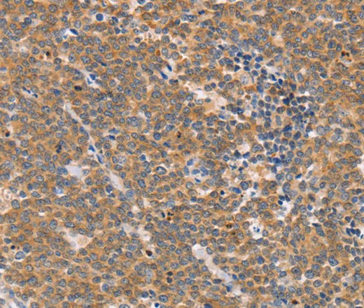 CD2AP Polyclonal Antibody - image 1