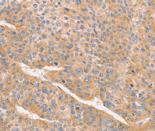 CD2AP Polyclonal Antibody - image 2