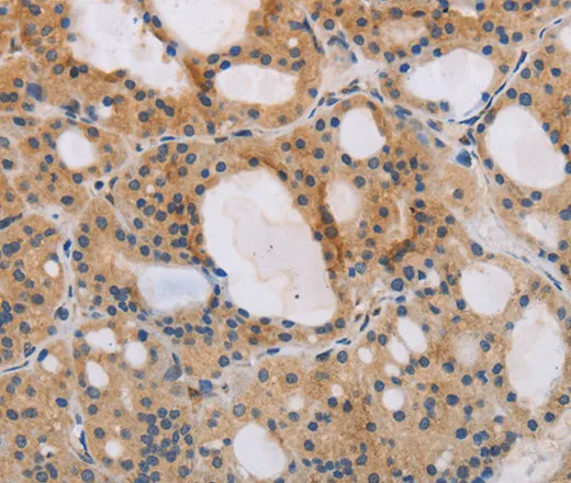 ITPR1 Polyclonal Antibody - image 1