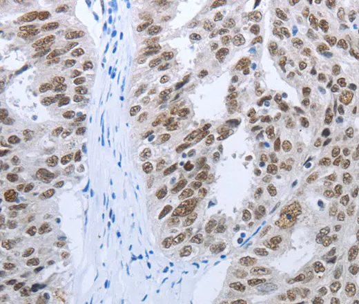 RBMS1 Polyclonal Antibody - image 1
