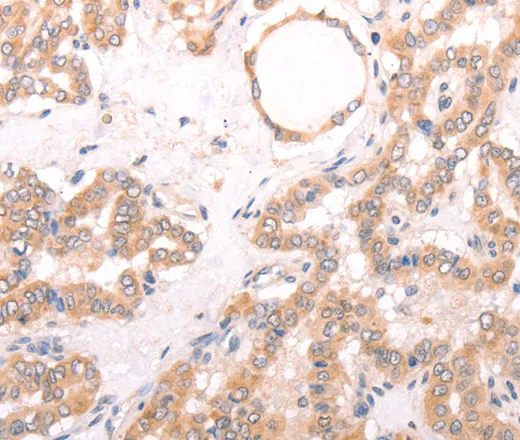 TRPV4 Polyclonal Antibody - image 1