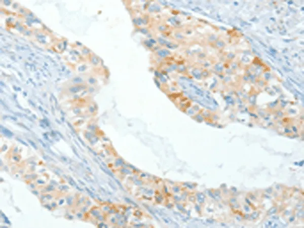 APOL2 Polyclonal Antibody - image 1