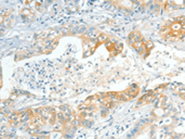 APOL2 Polyclonal Antibody - image 2