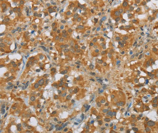 FOXB1 Polyclonal Antibody - image 1