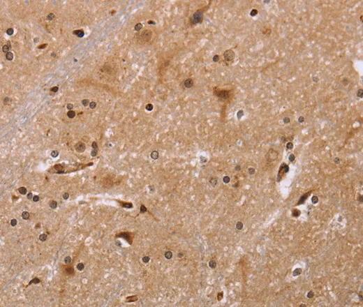 FBP2 Polyclonal Antibody - image 1