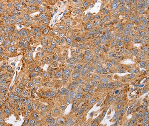 MAP2K5 Polyclonal Antibody - image 1