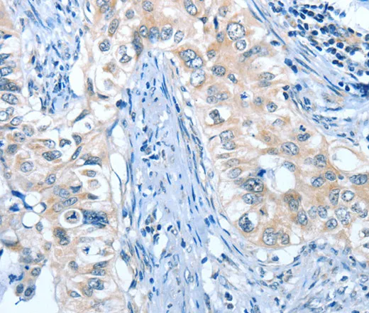 ANGPT2 Polyclonal Antibody - image 1
