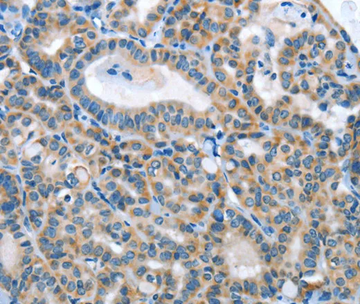 ANGPT2 Polyclonal Antibody - image 2