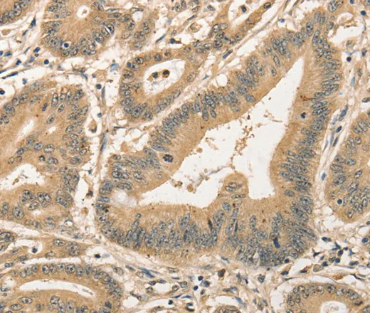 CDCA8 Polyclonal Antibody - image 1