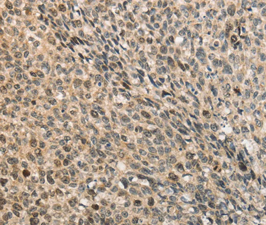 CDCA8 Polyclonal Antibody - image 2