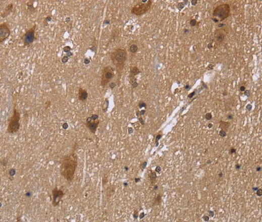 C-Rel Polyclonal Antibody - image 1