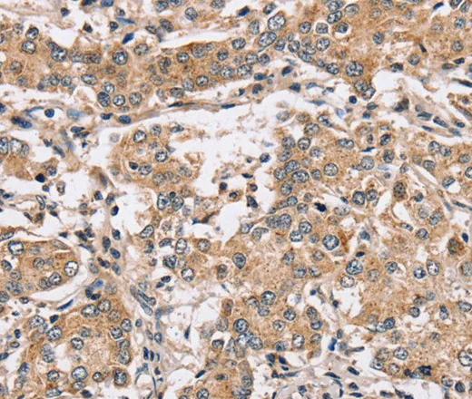 PPP1CC Polyclonal Antibody - image 1