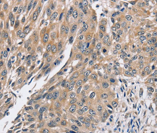 PPP1CC Polyclonal Antibody - image 2