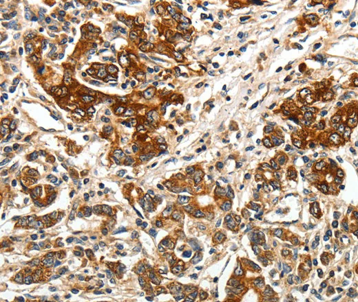 BIRC6 Polyclonal Antibody - image 1
