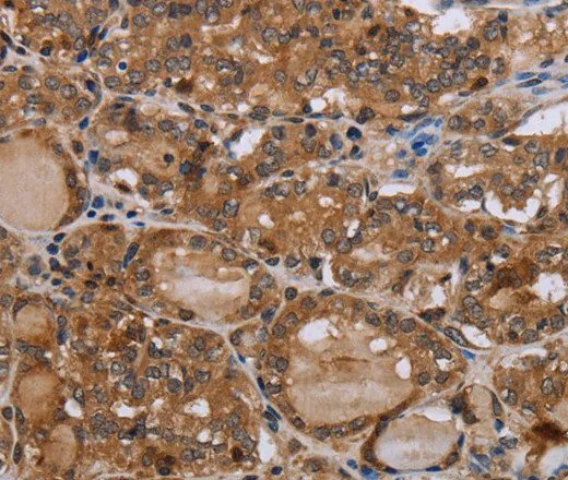 MT-ND1 Polyclonal Antibody - image 1