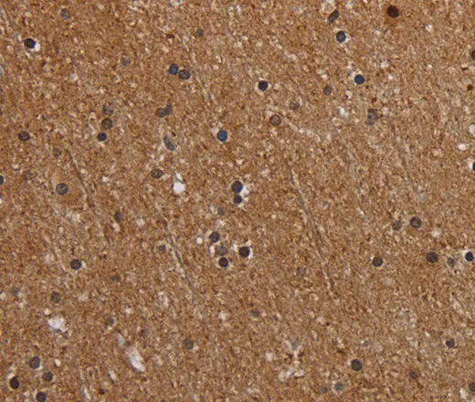 MT-ND1 Polyclonal Antibody - image 2