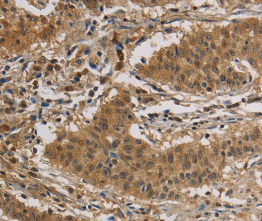CASP3 Polyclonal Antibody - image 1