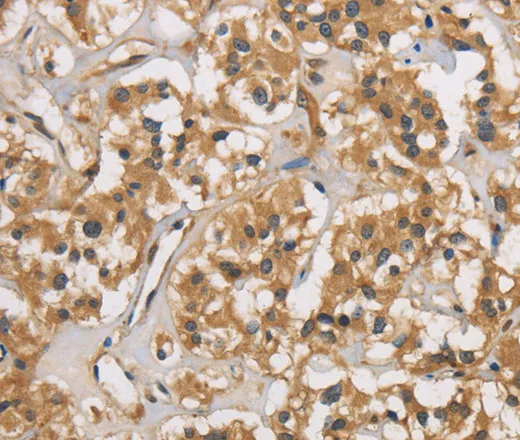 CASP3 Polyclonal Antibody - image 2