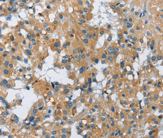 FGF9 Polyclonal Antibody - image 1